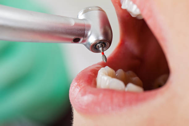 Best Broken Tooth Emergency  in Dranesville, VA